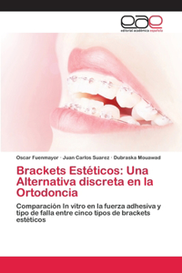 Brackets Estéticos