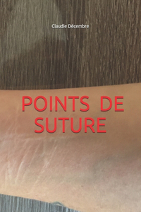 Points de Suture