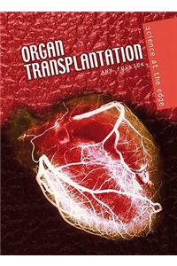 Organ Transplantation