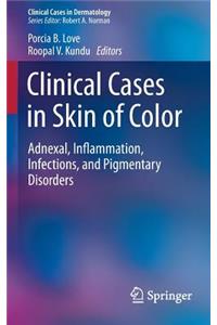 Clinical Cases in Skin of Color