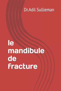 Le mandibule de fracture