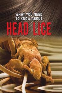 What You Need to Know about Head Lice