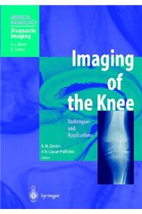 Imaging of the Knee