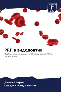 Prf в эндодонтии