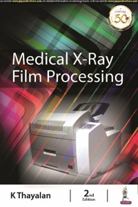Medical X-Ray Film Processing