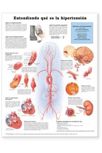 Understanding Hypertension Anatomical Chart in Spanish (Entendiendo Que Es la Hypertension)