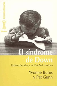 El sindrome de Down: estimulacion y actividad motora