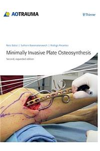 Minimally Invasive Plate Ostheosynthesis