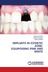 Implants in Esthetic Zone