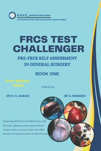 frcs test challenger