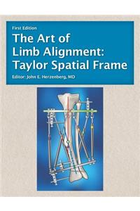 Art of Limb Alignment