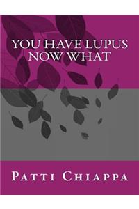 You have Lupus Now what