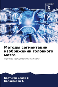 Методы сегментации изображений головног&