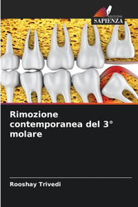 Rimozione contemporanea del 3° molare