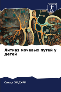Литиаз мочевых путей у детей