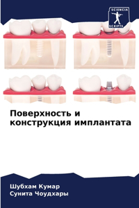 Поверхность и конструкция имплантата