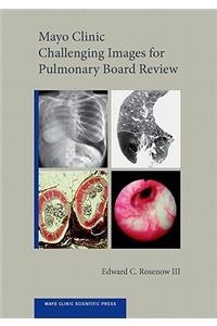 Mayo Clinic Challenging Images for Pulmonary Board Review