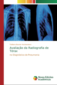 Avaliação da Radiografia de Tórax