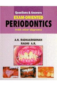 Exam Oriented Periodontics: Questions and Answers