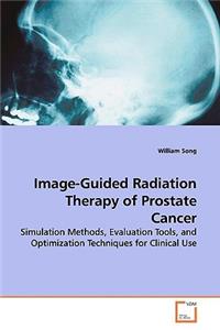 Image-Guided Radiation Therapy of Prostate Cancer