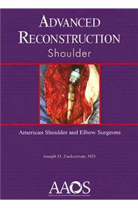 Advanced Reconstruction: Shoulder