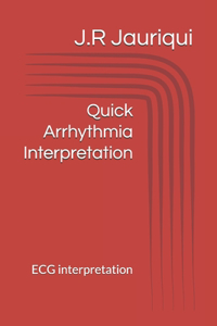 Quick Arrhythmia Interpretation