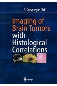 Imaging of Brain Tumors with Histological Correlations