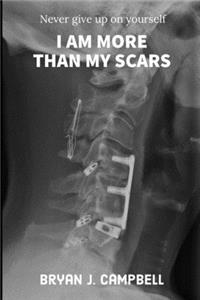 I Am More Than My Scars