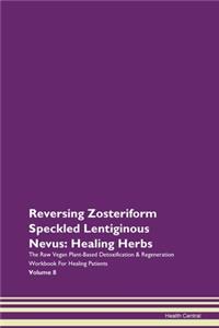 Reversing Zosteriform Speckled Lentigino