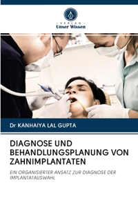 Diagnose Und Behandlungsplanung Von Zahnimplantaten