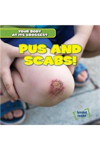 Pus and Scabs!