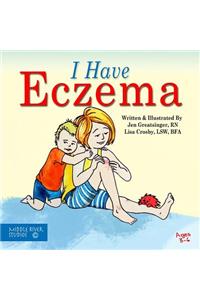 I Have Eczema