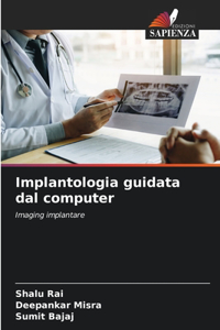 Implantologia guidata dal computer