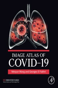Image Atlas of COVID-19