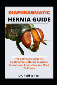 Diaphragmatic Hernia Guide