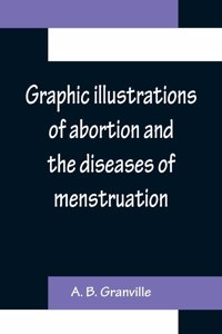 Graphic illustrations of abortion and the diseases of menstruation; Consisting of Twelve Plates from Drawings Engraved on Stone, and Coloured by Mr. J. Perry, and Two Copper-plates from the Philosophical Transactions, Coloured by the Same Artist. t