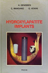 Hydroxylapatite Implants