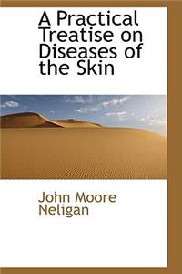 A Practical Treatise on Diseases of the Skin