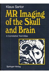 MR Imaging of the Skull and Brain