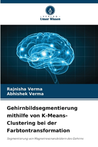 Gehirnbildsegmentierung mithilfe von K-Means-Clustering bei der Farbtontransformation