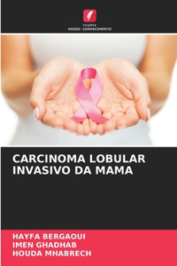 Carcinoma Lobular Invasivo Da Mama