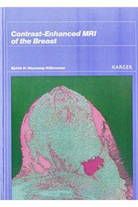 Contrast-Enhanced MRI of the Breast