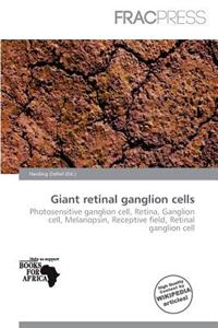 Giant Retinal Ganglion Cells