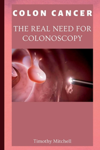 Colon Cancer