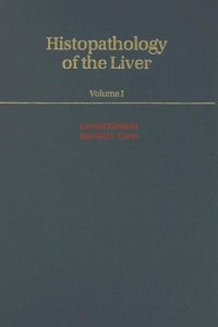 Histopathology of the Liver