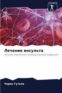 Лечение инсульта