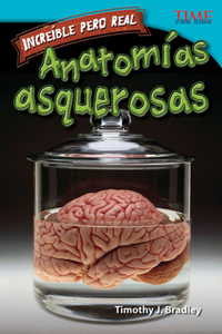 Increíble Pero Real: Anatomía Gruesa (Strange But True: Gross Anatomy) (Spanish Version)