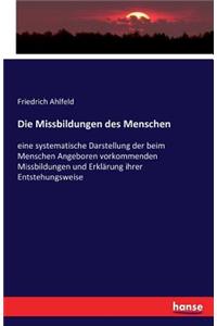 Missbildungen des Menschen