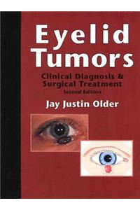 Eyelid Tumors