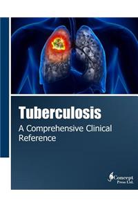Tuberculosis